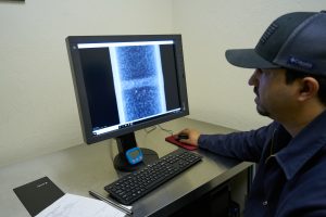 Computed Radiography